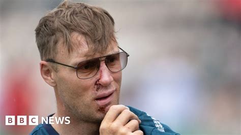 Freddie Flintoff Agrees Compensation Over Top Gear Crash Bbc News