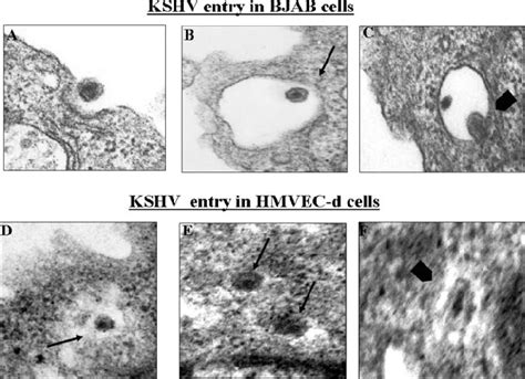 3 Electron Microscopic Observation Of Kshv Entry Into Bjab And Hmvec D Download Scientific