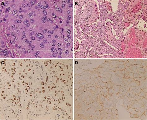 Histopathological Evaluation Hematoxylin And Eosin He Histologic