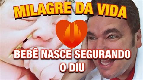 BEBÊ NASCE SEGURANDO O DIU QUE O IMPOSSIBILITARIA DE NASCER YouTube