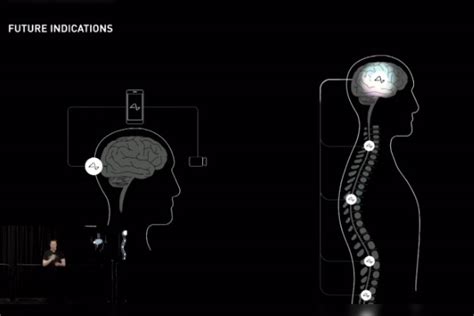 Musk comenzará a probar sus chips cerebrales en humanos en seis meses