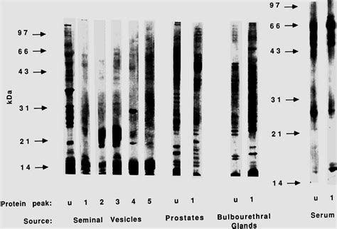 One Dimensional Sds Page Of Heparin Binding Protein Peaks From Bovine Download Scientific