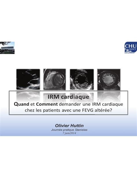 L Irm Quand Et Comment Demander Une Irm Cardiaque