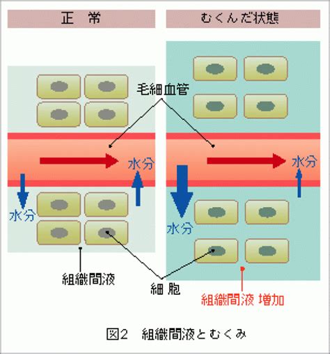 実はその太さ脂肪じゃないかも！？ダイエット前に見てほしいむくみのセルフチェックと解消法！ Weboo ウィーブー 暮らしをつくる