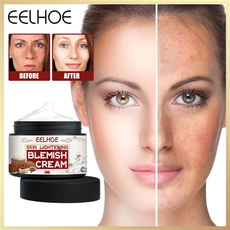 Eelhoe Powerful Whitening Freckle Cream Removing Black Spots Melanin