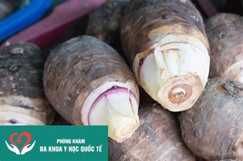 Ăn khoai môn có béo không Khoai môn có tác dụng gì