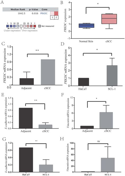 Dna Pkcs Expression Was Significantly Upregulated In Cscc Human Skin