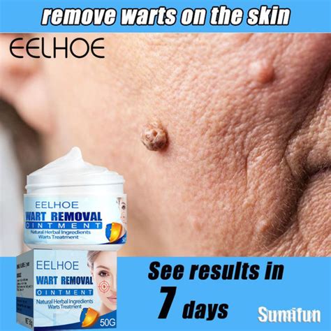 Eelhoe Wart Removal Cream Warts Remover Original Skin Remover Skin Growth Warts Remover Mole And