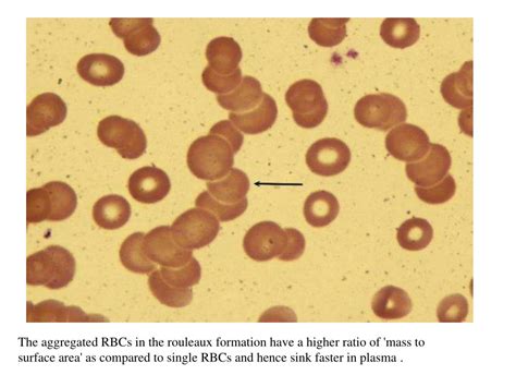 Ppt Erythrocyte Sedimentation Rate Powerpoint Presentation Free