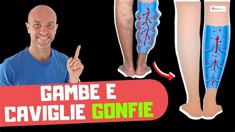 Il modo più rapido facile e sicuro per curare le GAMBE GONFIE YouTube