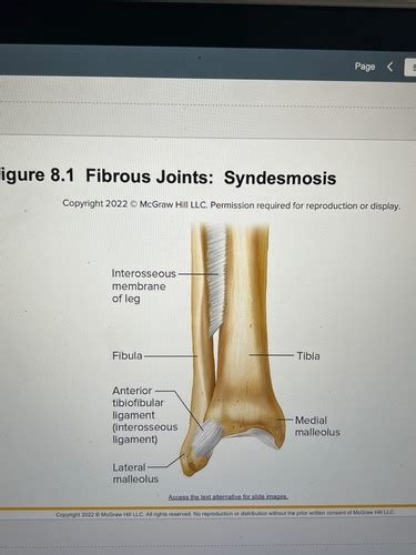 Joints Flashcards Quizlet