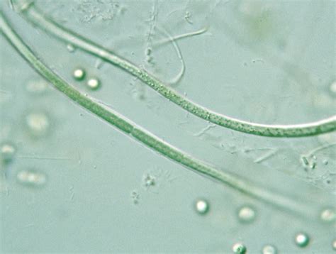 prokaryote phormidium