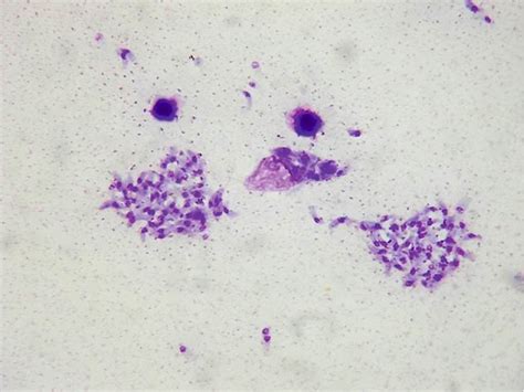 Паразит токсоплазма гонди (лат. Toxoplasma gondii)