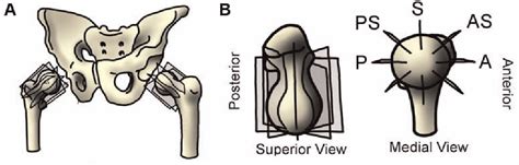 Figure 1 From Reference Values For Proximal Femoral Anatomy In Adolescents Based On Sex Physis