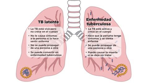 El Vih Y La Tuberculosis Tb