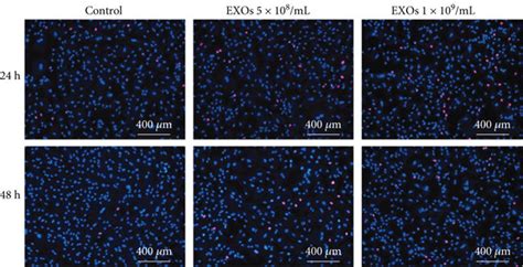 Hbmsc Exos Improve Cell Viability And Proliferation In Chondrocytes