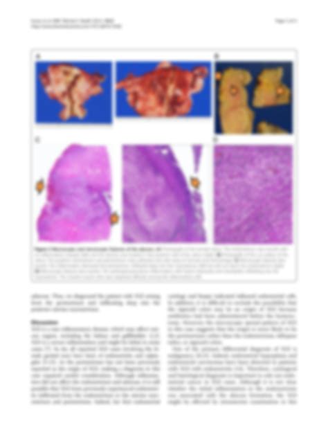 SOLUTION Xanthogranulomatous Inflammation Of The Perimetrium With