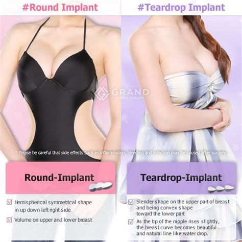 5 Urban Legends About Breast Augmentation Infographic Artofit