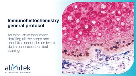 Immunohistochemistry General Protocol Abyntek Biopharma