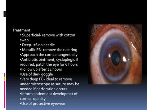 Ocular Trauma Ppt