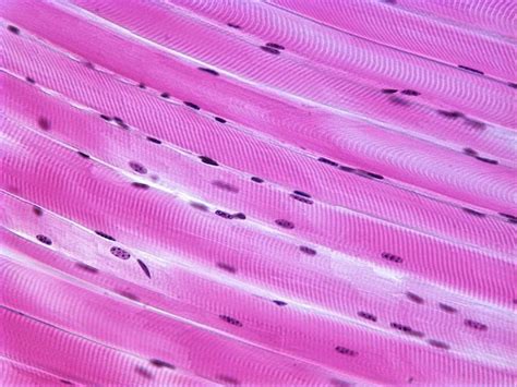 Skeletal Muscle Histology Labeled - vrogue.co