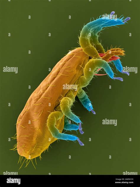 Coloured Scanning Electron Micrograph Sem Of Northern Fowl Mite