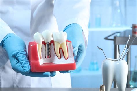 Maxillary Anterior And Mandibular Posterior Fixed Prosthesis Case