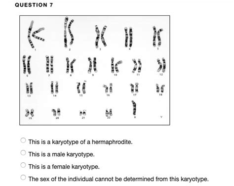 Solved Question 5 18 The Sex Of The Individual Cannot Be