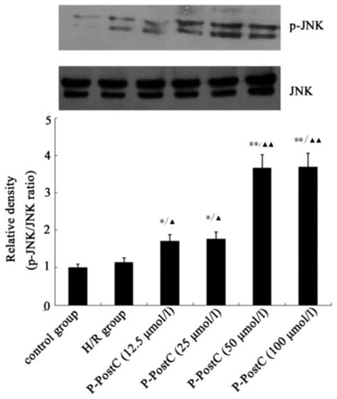 Propofol Postconditioning Protects H C Cells From Hypoxia