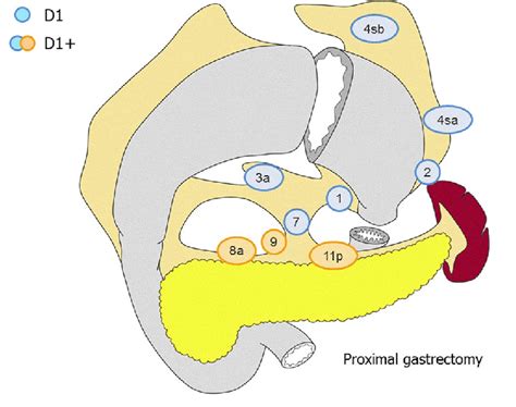 Lymph Node Dissection In Proximal Gastrectomy Lymph Node Stations In