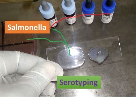 Serotyping Of Salmonella Introduction Types And Risk Factors Of Salmone