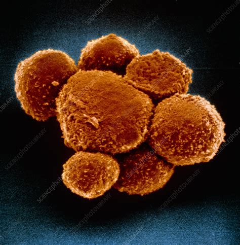 False Colour SEM Of A Cluster Of Hybridoma Cells Stock Image G400