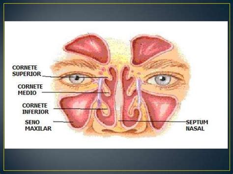 Cornete Inferior