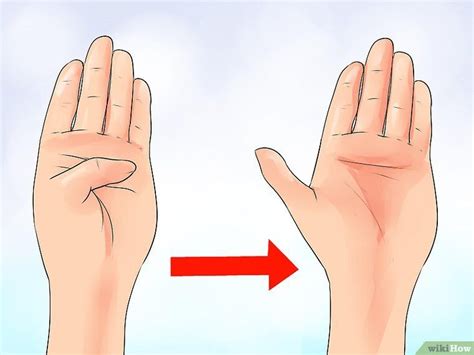 When To Have Carpal Tunnel Surgery Mapasgmaes