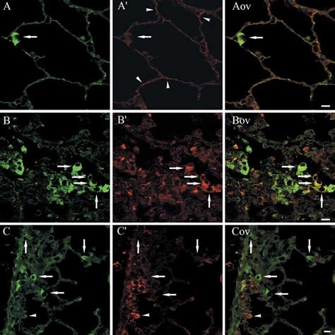 A C Double Labeling Immunofluorescence And Laser Scanning Microscopy