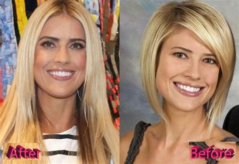 Christina El Moussa Plastic Surgery Still Beautiful Lights Fashion