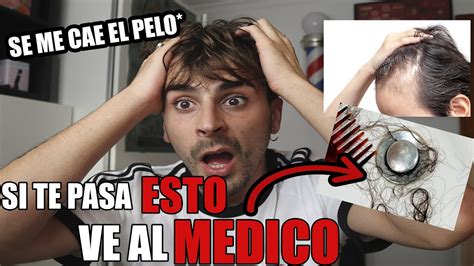 Se Me Cae El Pelo Si Te Pasa Esto Te Estas Quedando Calvo Youtube