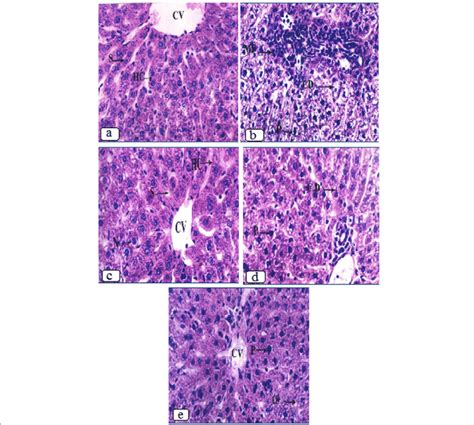 Photomicrographs Of Liver Sections From Control And Treated Groups