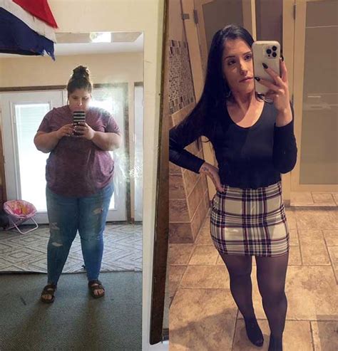 Gastric Sleeve Success Stories: Before & After Photos