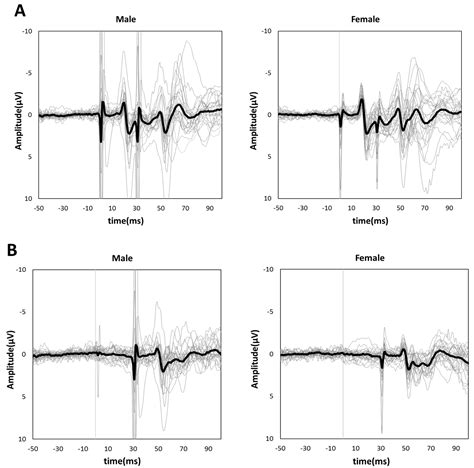 Brain Sciences Free Full Text Sex Differences In Excitatory And