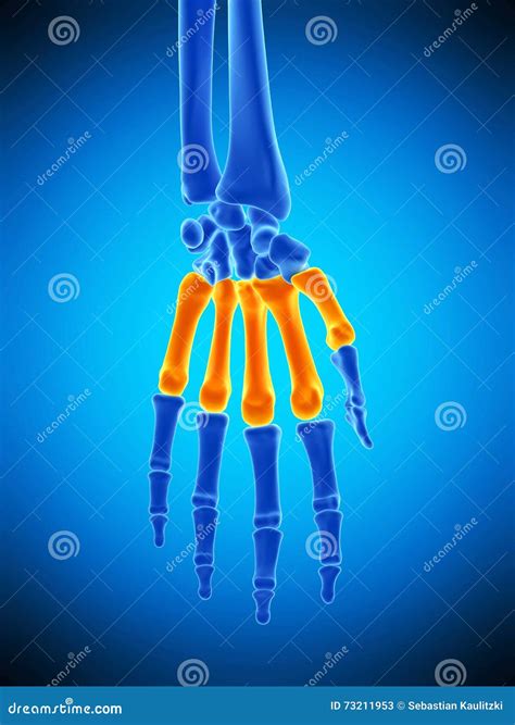 D Illustration Of Of Metacarpal X Ray Cartoondealer