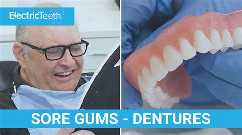 What Is Good For Sore Gums From Dentures Youtube