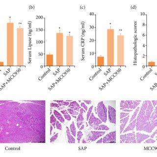 Protective Effect Of Mcc On Intestinal Injury In Acute Pancreatitis