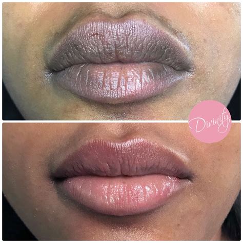 Which Style Gives The Most Natural Lip Blushing Results Artofit