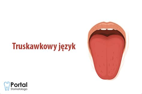 Truskawkowy J Zyk Portal Stomatologa