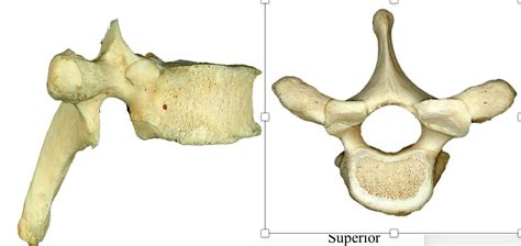 Typical Thoracic Vertebra Diagram Quizlet