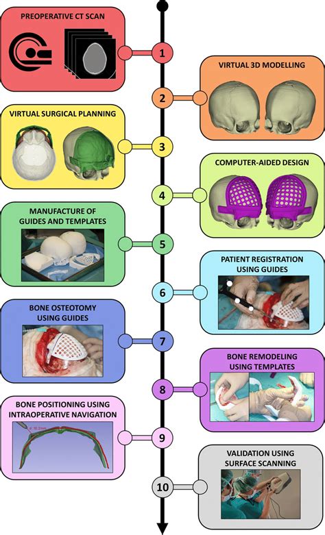 Proposed Workflow For Surgical Correction Of Craniosynostosis Download Scientific Diagram