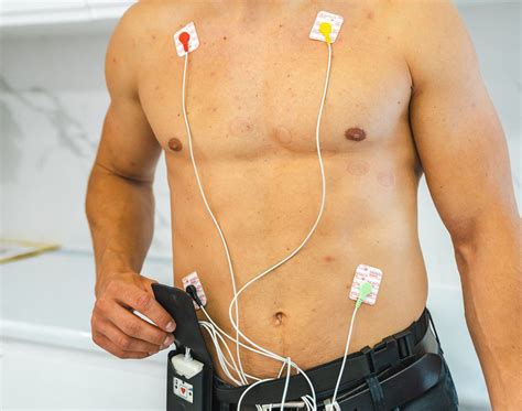 Holter Ekg Pozna Neomedica Um W Si Ju Dzi