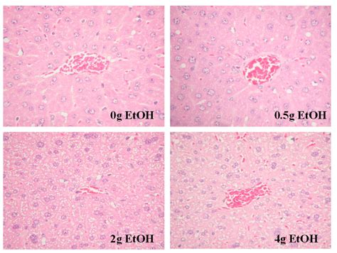 Histopathological Changes In Livers In Sam P Mice Fed With Ethanol