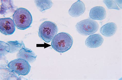 Meiosis Prophase 1 Microscope